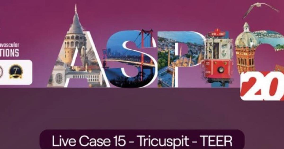 ASPIC 2025 canlı vaka 15: triküspit TEER ekran görüntüsü