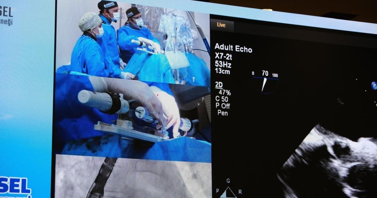 Echocardiography and fluoroscopy images during a live case